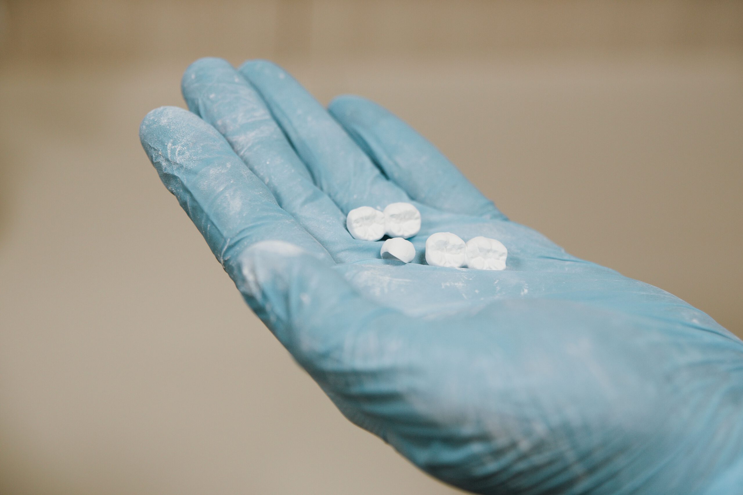 Zahnersatz White artificial teeth for denture placed on hand in blue latex glove against light blurred background