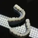 Detailed view of dental veneers placed on a dark reflective surface, showcasing dental craftsmanship.